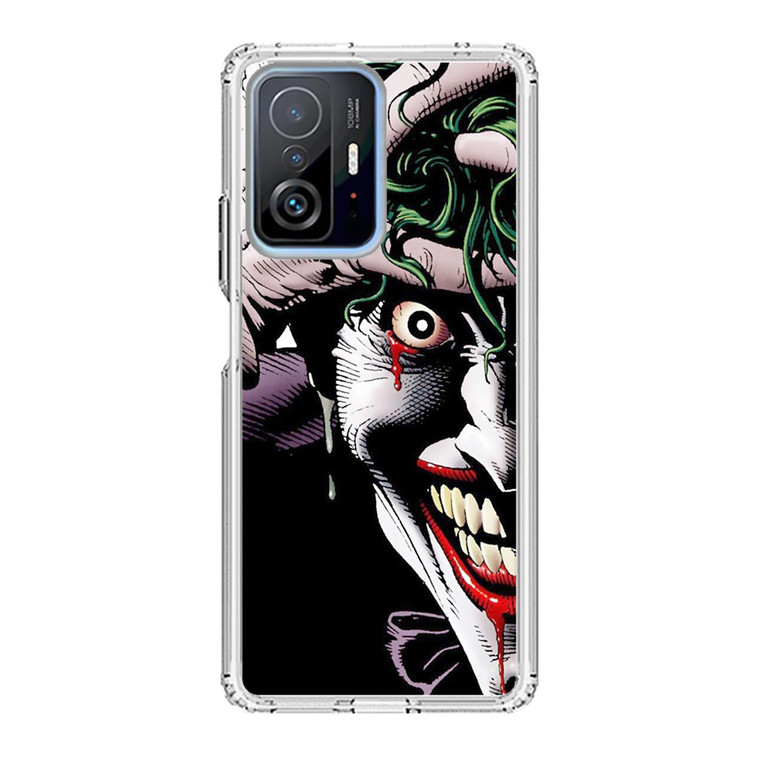 Joker Xiaomi 11T Pro Case