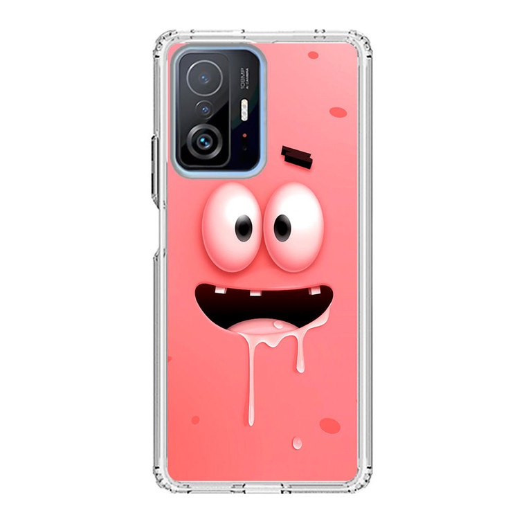 Spongebob Patrick Star Xiaomi 11T Pro Case