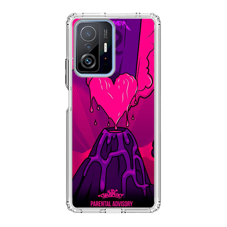 Lil Uzi Vert Luv Is Rage 1,5 Xiaomi 11T Pro Case