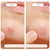 DiscoverNight NIGHT Pimple Patches, for Toughest Acne, 48 ct – package view 4