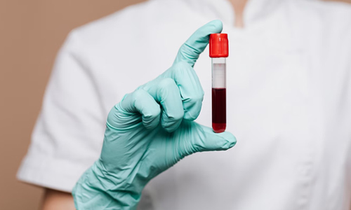 Determinación de parámetros bioquímicos, glucosa, triglicéridos y colesterol total en sangre capilar