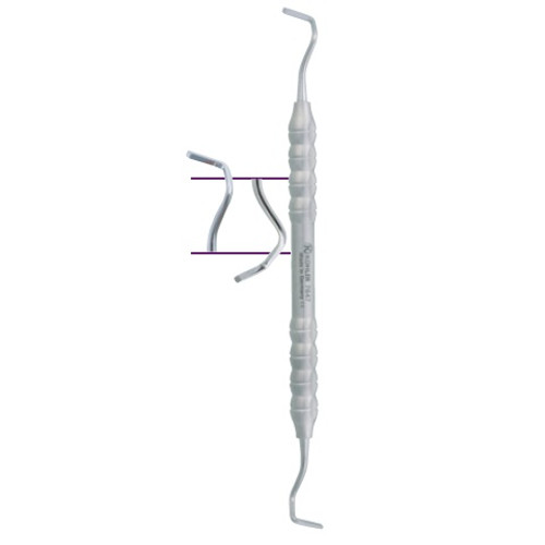 Kohler Ochsenbein #3 Periodontal Chisel with Trinovo Style Handle (7647) Kohler Ochsenbein #3 Periodontal Chisel with Trinovo Style Handle (7647)