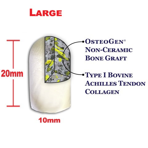 Impladent 10mm x 20mm Large OsteoGen Plug (OPL1020-5)
