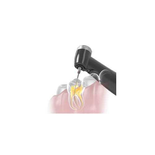 J. Morita Tri Auto ZX2+ Endodontic Handpiece & Apex Locator