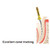 PacDent Pac-Taper™ Conform Assorted 25mm Rotary Files - 6/Pack PacDent Pac-Taper™ Conform Assorted 25mm Rotary Files - 6/Pack