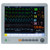 Edan IM80 Basic Vital Sign Patient Monitor with 15" Touch Screen (IM80.S.T.)
