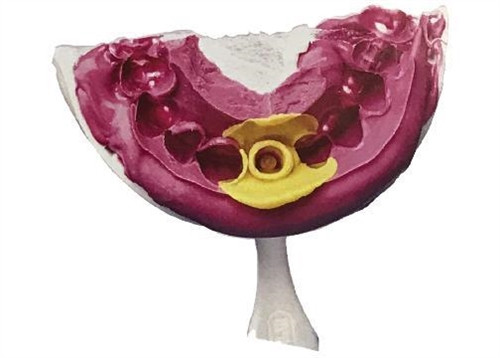 MiTi 40 Kit VPS Impression Material for Crowns, Bridges, & Veneers, 11x50/box Valuemed