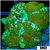 Teal Striped Discosoma