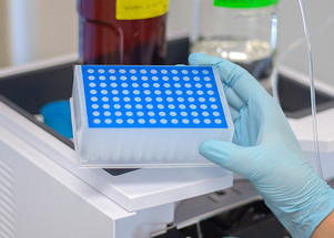 The Different 96 Well Plate Bottom Shapes
