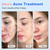 165-Piece Acne Pimple Patches – Hydrocolloid + Salicylic Acid Blemish Covers