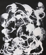 Undulation
