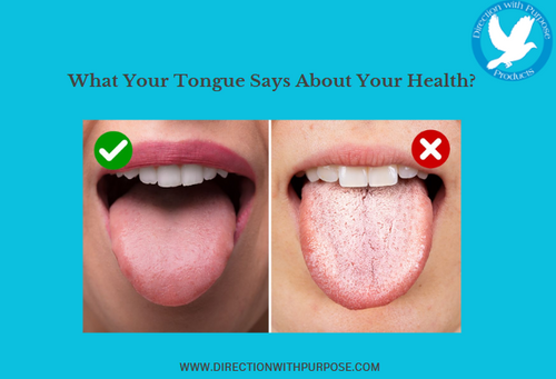 What Your Tongue Says About Your Health?