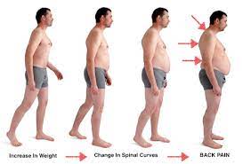 The Link Between Weight and Back Pain - Jaspal Ricky Singh, M.D