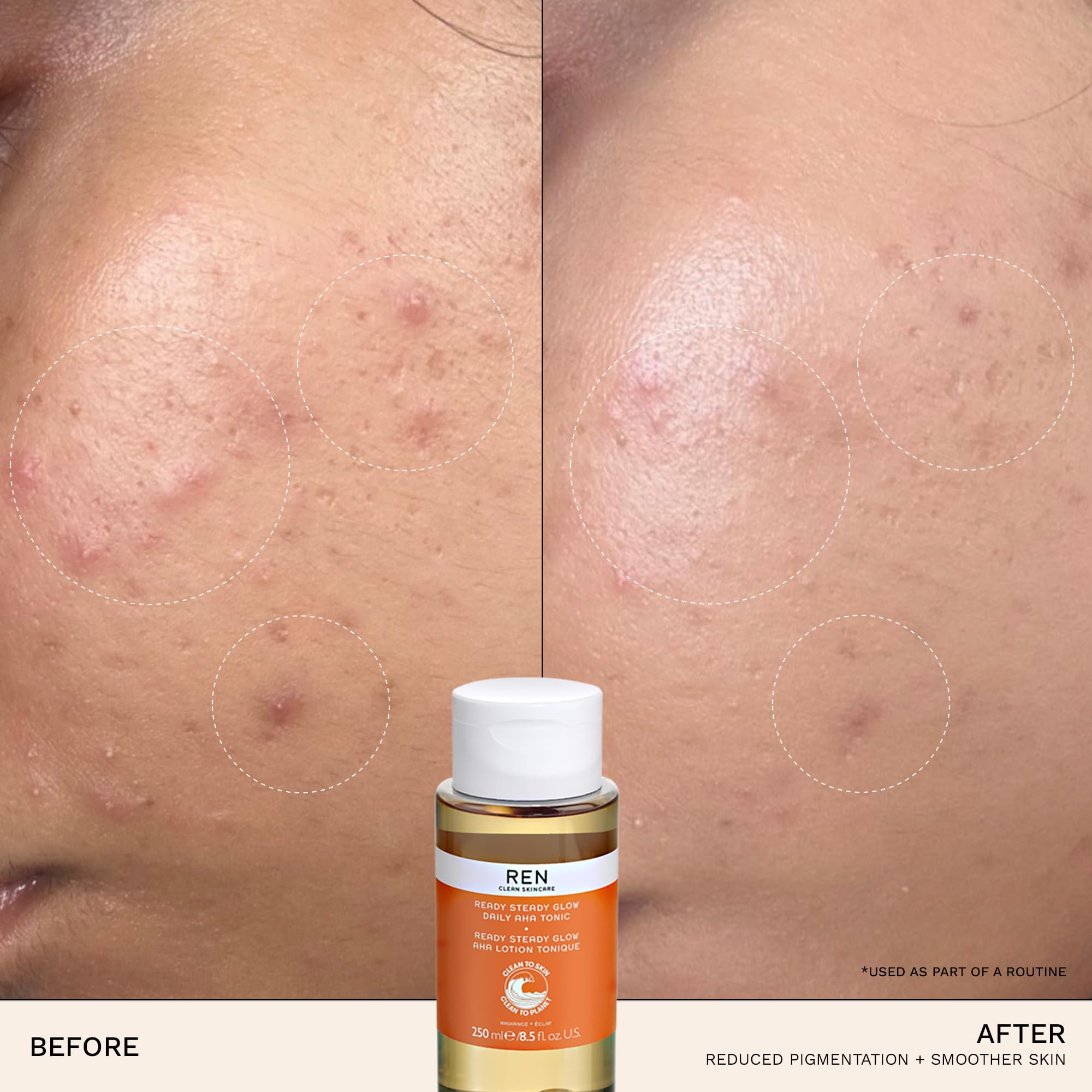 REN Ready Steady Glow Daily AHA Tonic, 100ml – Exfoliating Toner with Lactic Acid and Salicin, Brightens Skin, Reduces Pores and Fine Lines, Smooths Texture for an Even Complexion