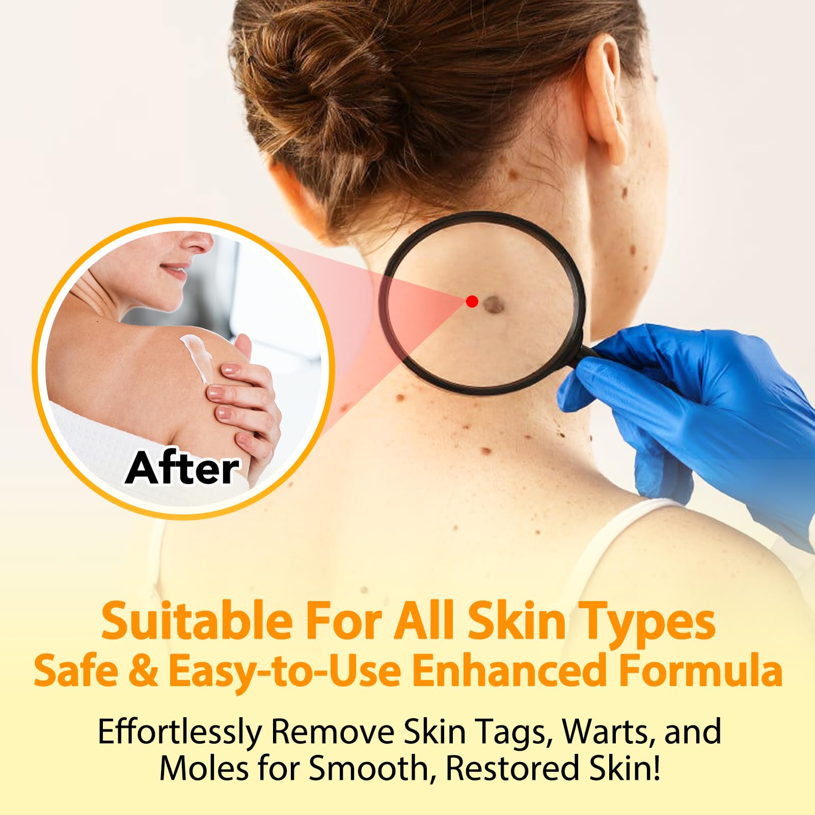 Bee Venom Tag Remover 100g, Bee Venom Moles and Warts Removal Cream, Tag Recede Bee Venom Mole Treatment Cream, Tag Recede Bee Venom for Skin