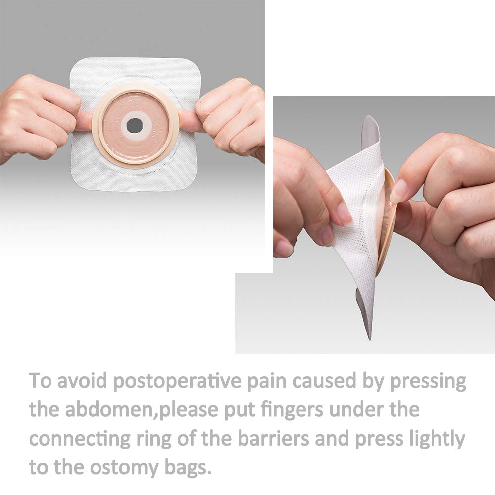 Carbou 21 PCS Ostomy Supplies Colostomy Bags Two Piece Drainable Pouches with Closure 12", Ileostomy Stoma Care,Cut-to-Fit(15pcs Bags+6pcs Barrier)