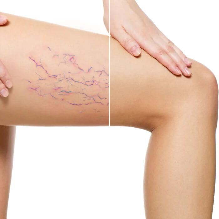 LUMINESS Airbrush Body Coverage - Tattoo Cover Up Makeup - Full Coverage Foundation for Face & Body - Water-Resistant, Long-Wear, Natural Radiant Finish, Light Medium