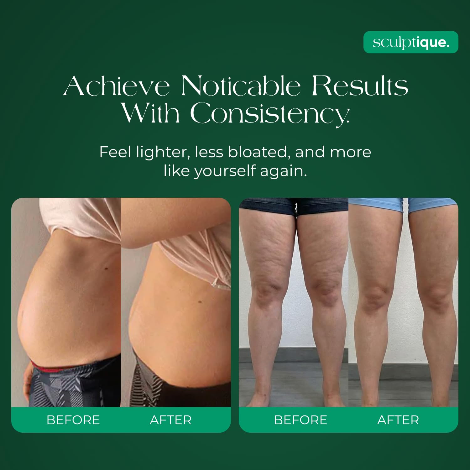 Sculptique Lymphatic Drainage Supplement – Lymphatic Drainage Capsules with Dandelion, Burdock, Cleavers & Echinacea, Supports Bloating, Fluid Balance & Daily Lymphatic Wellness – 60 Capsules