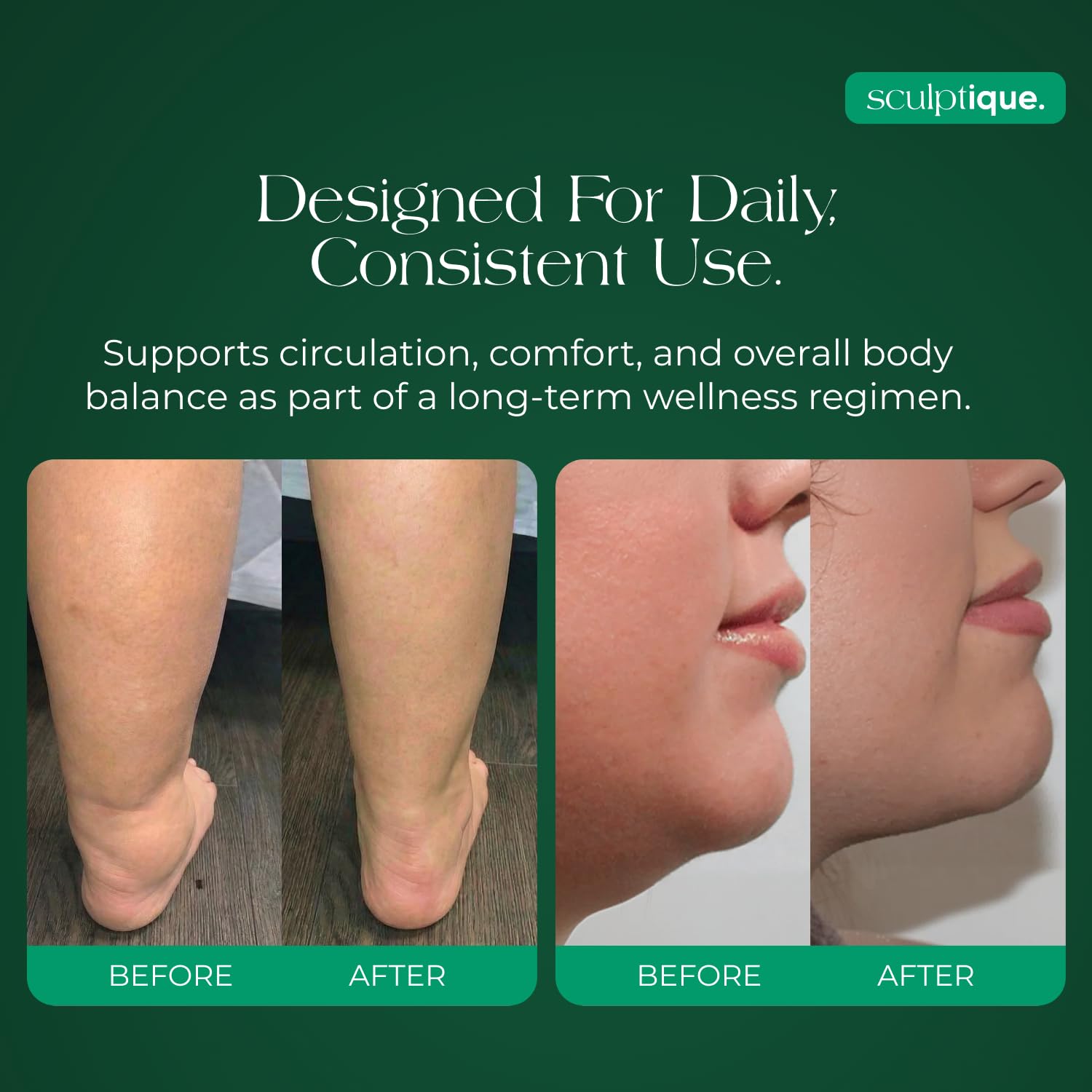 Sculptique Lymphatic Drainage Supplement – Lymphatic Drainage Capsules with Dandelion, Burdock, Cleavers & Echinacea, Supports Bloating, Fluid Balance & Daily Lymphatic Wellness – 60 Capsules