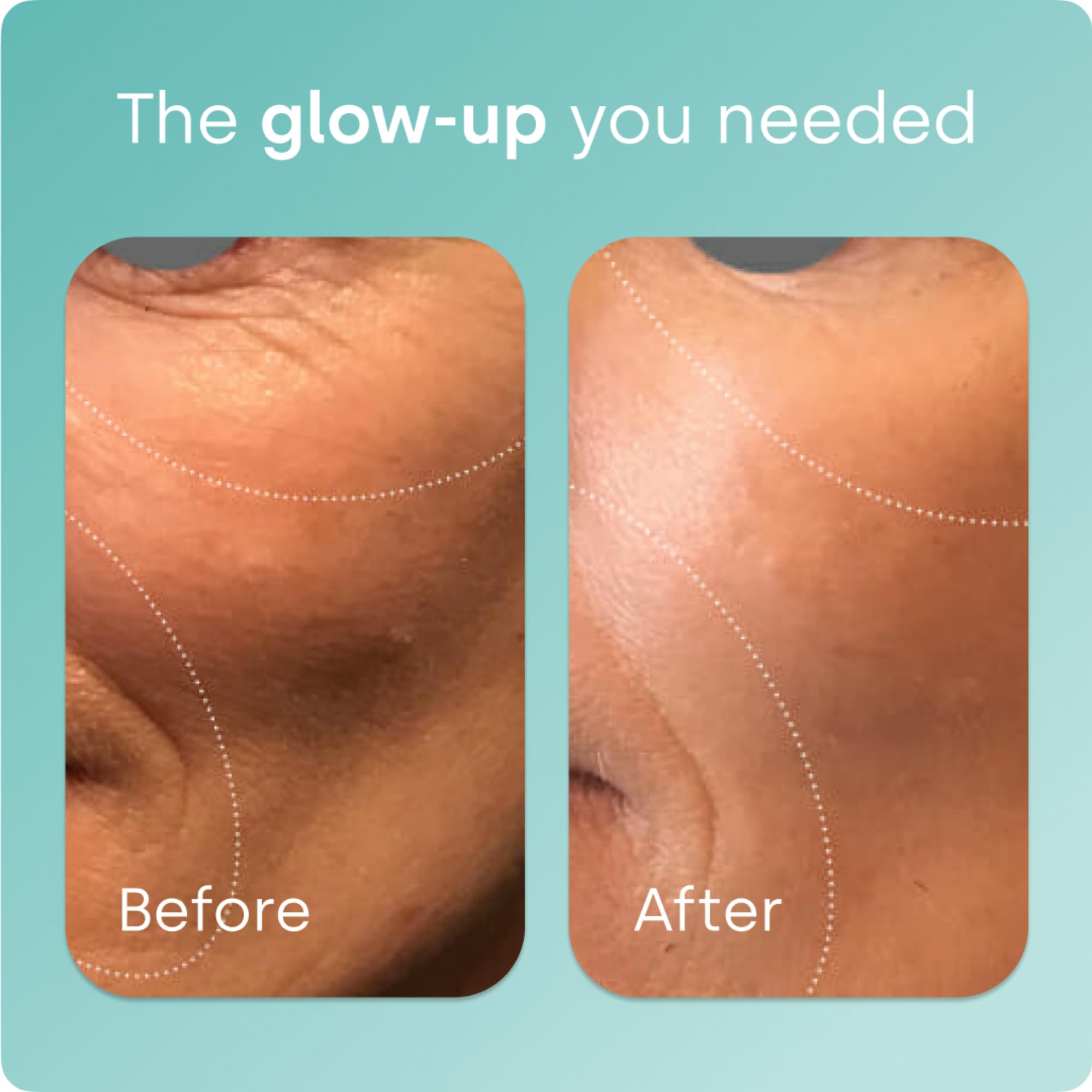 Biosil Collagen Booster Supplement - 120 Original Capsules - Patented ch-OSA Activator for Skin, Hair, Nails & Joints - Supports Natural Production - 60-Day Supply