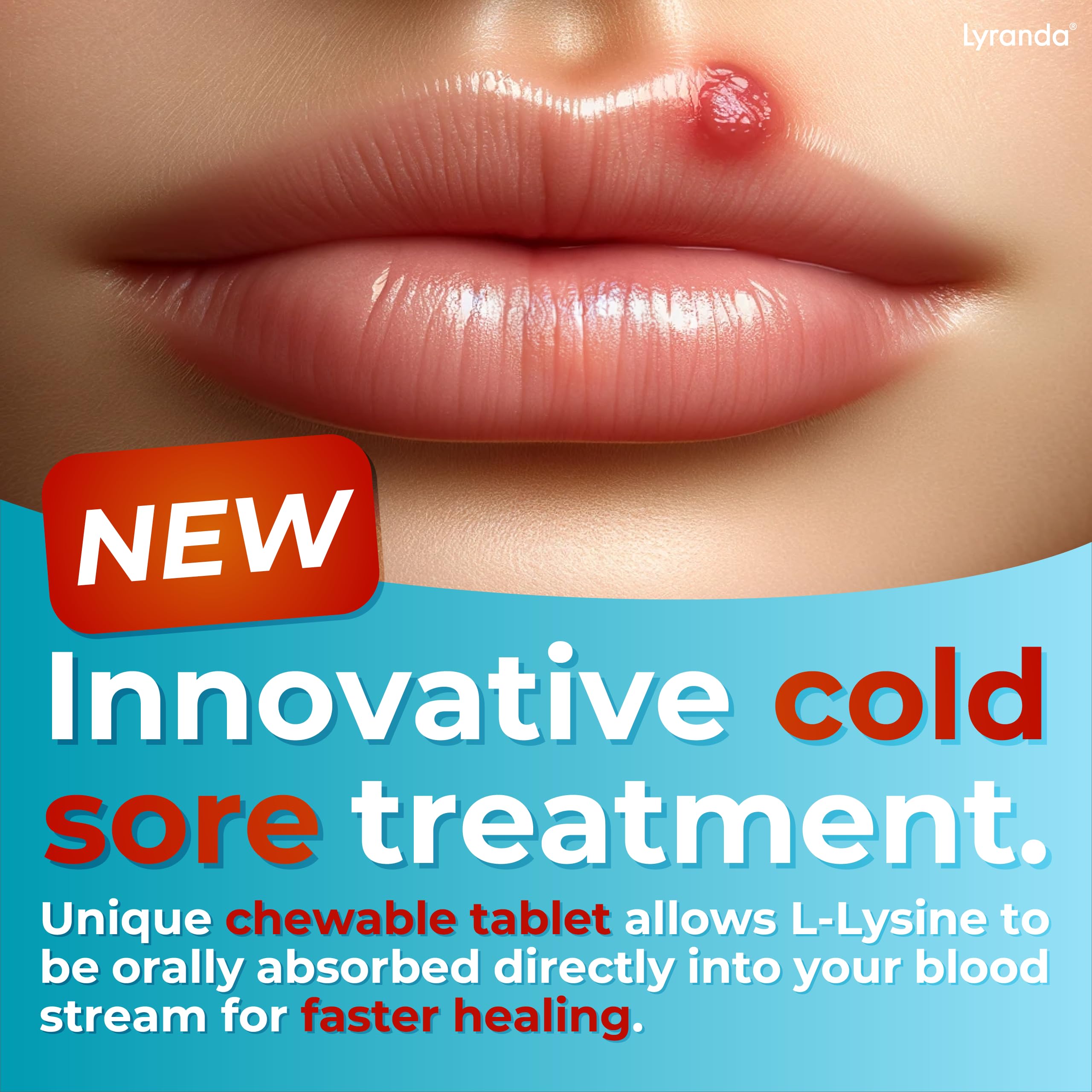 Lyranda® - Lysine Cold Sore Treatment - Chewable L-Lysine Tablets - Faster Absorption and Better Hygiene