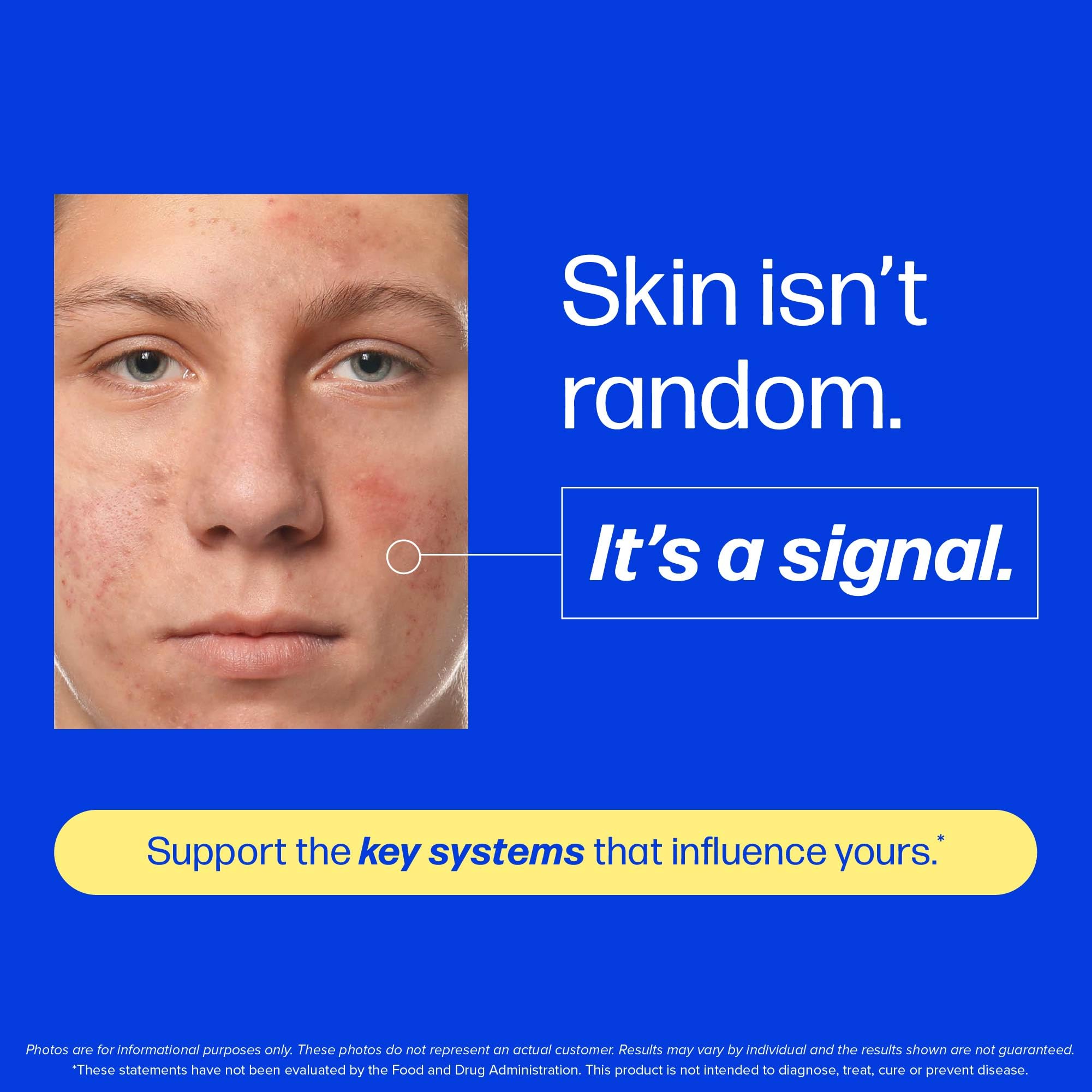 Clear Skin Supplement with Zinc, DIM & Probiotics | 3-in-1 Balance, Glow & Health Skin Support | Triple Action Hyaluronic Acid, Niaciminide & Vitamins for Hormone, Complexion & Gut Support | 60 Ct