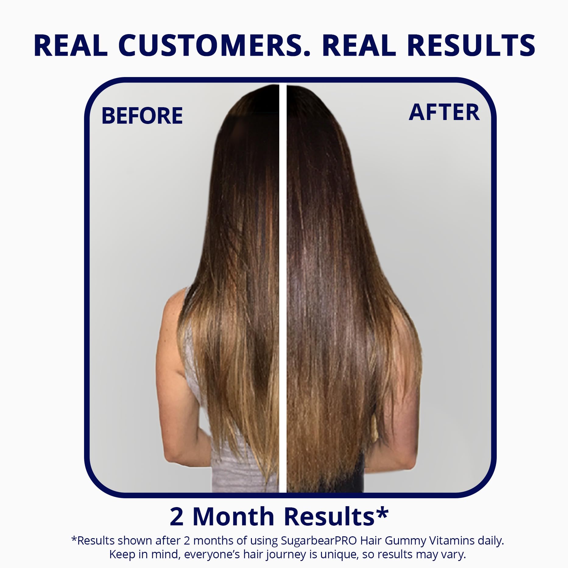 SugarBearPro Hair Vitamin Gummy 3 Month Supply Extra Strength Biotin 6000mcg, Growth for Men & Women, Vegan Vitamin B12, MSM, Inositol, Omega 3, Elderberry, Certified Kosher, Halal, Cruelty-Free