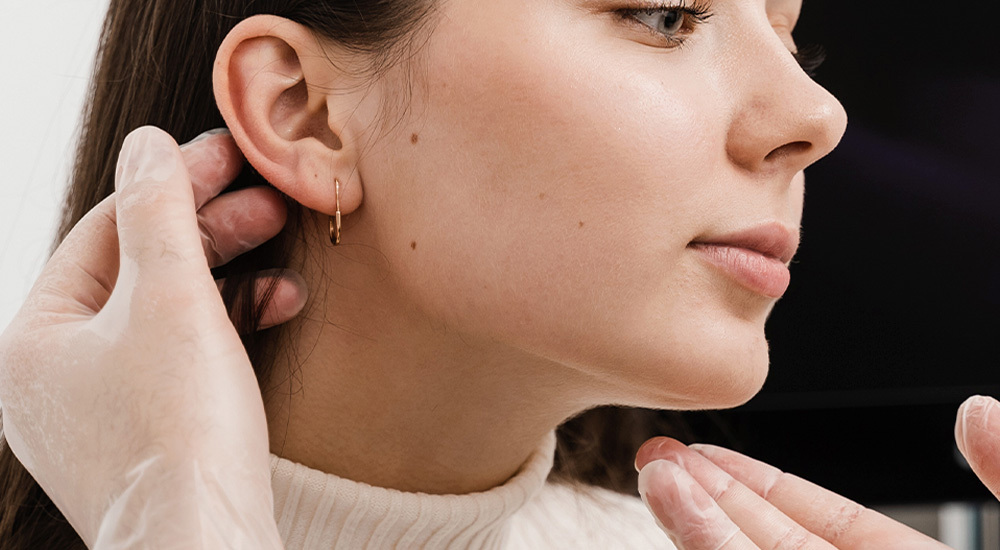 servicio perforación del lóbulo 1