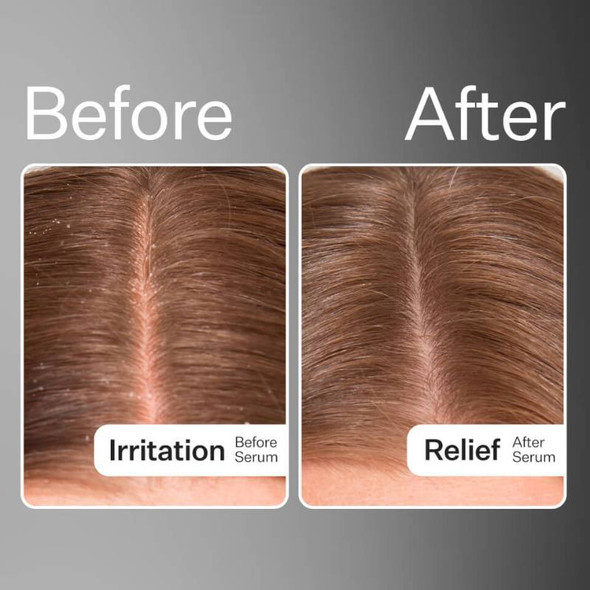 Act + Acre Microbiome Cooling Scalp Serum 65ml Lifestyle 