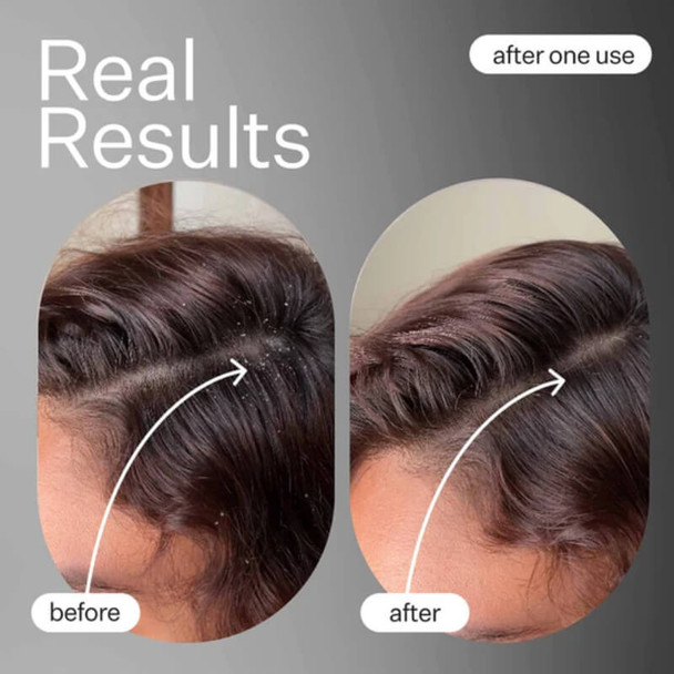 Act+Acre Scalp Detox 89ml - Lifestyle 3