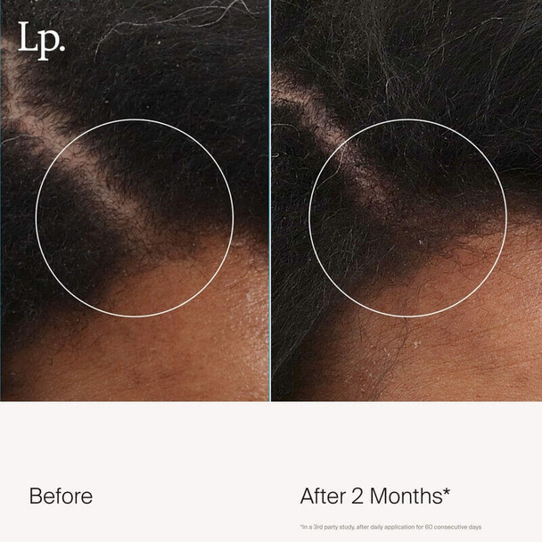 Living Proof Scalp Care Revitalizing Treatment - 73 ml Before/After