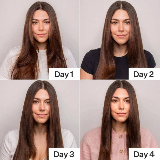 Act + Acre 4% Niacinamide Serum 65ml 4