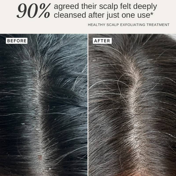 Alpha-H Healthy Scalp Treatment 100ml 3