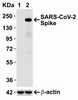 SARS-CoV-2 (COVID-19) Spike Antibody