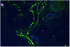 SARS-CoV-2 (COVID-19) Spike Antibody