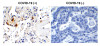 SARS-CoV-2 (COVID-19) Envelope Antibody | 3531