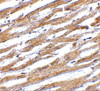 PD-L1 Antibody