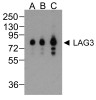 LAG3 Antibody [5F11]
