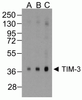 TIM3 Antibody [1B10]