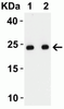 SARS-CoV-2 (COVID-19) Envelope Antibody