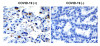 SARS-CoV-2 (COVID-19) Envelope Antibody