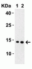 SARS-CoV-2 (COVID-19) Membrane Antibody | 9157