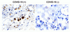 SARS-CoV-2 (COVID-19) Membrane Antibody | 9157