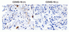 SARS-CoV-2 (COVID-19) NSP2 Antibody