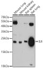 IL6 Antibody | 13-918