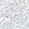 IL6 Antibody | 13-918