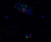 SARS-CoV-2 (COVID-19) Spike G142D Δ143-145VYY Antibody (Omicron)