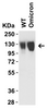 SARS-CoV-2 (COVID-19) Omicron Variant Spike S1 (His-Avi Tag) Recombinant Protein