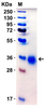 SARS-CoV-2 (COVID-19) Delta Variant Spike RBD (His-Avi Tag) Recombinant Protein