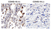 SARS-CoV-2 (COVID-19) ORF3b Antibody | 9279